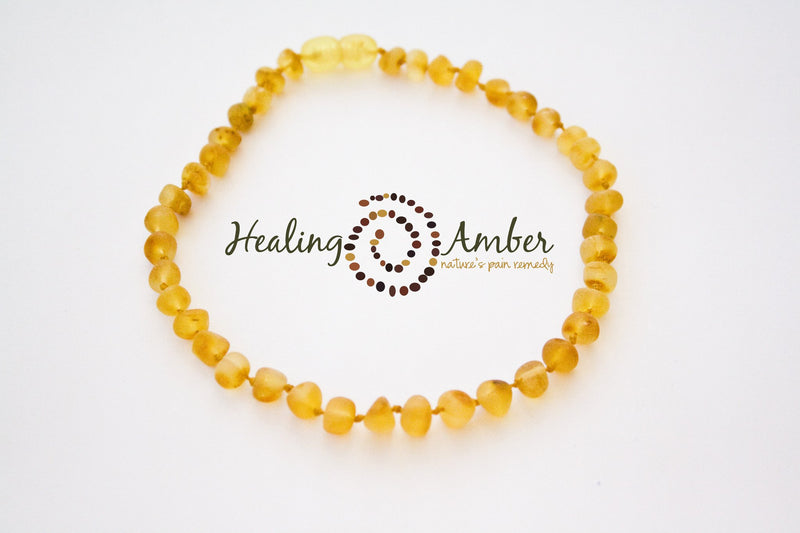 Healing Amber Necklace, Child/Teen 15"