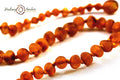 Healing Amber Anklet, 5.5-6.5"