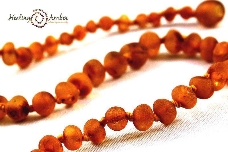 Healing Amber Anklet, 5.5-6.5"