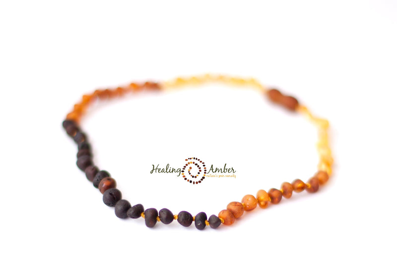 Adult Healing Amber Necklace (17.5" - 18")